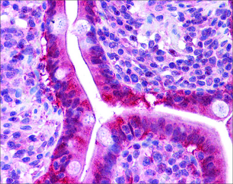 Anti-LGALS3 antibody produced in rabbit