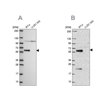 Anti-IRF6 antibody produced in rabbit