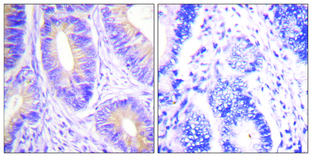 Anti-CBL antibody produced in rabbit