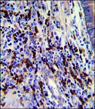 ANTI-CNOT8 (C-TERM) antibody produced in