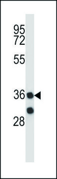 ANTI-MARCH11 (C-TERM) antibody produced in