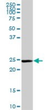 Anti-GSTM5 antibody produced in rabbit