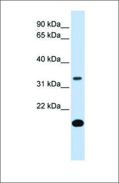 Anti-FST antibody produced in rabbit
