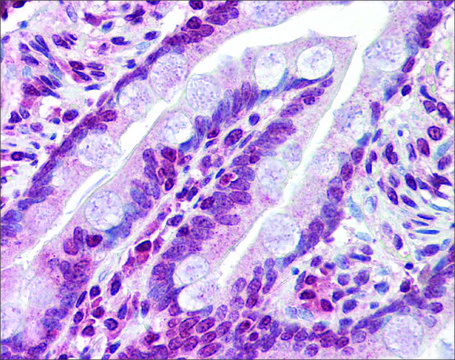 Anti-ABCC8 antibody produced in rabbit