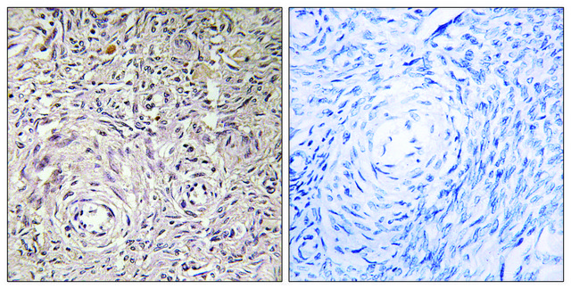 Anti-GCNT7 antibody produced in rabbit