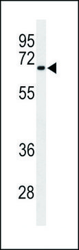ANTI-BT2A2 (C-TERM) antibody produced in