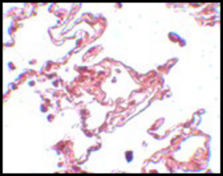 Anti-CCDC69 antibody produced in chicken