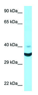 Anti-NCR1 (N-terminal) antibody produced in