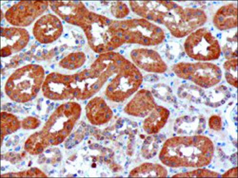 Anti-USH1C/Harmonin antibody produced in goat