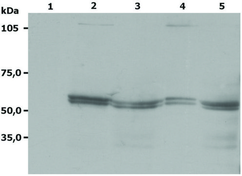 Monoclonal Anti-LYN antibody produced in