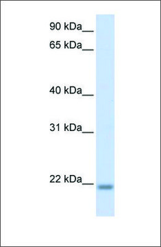 Anti-CNBP antibody produced in rabbit