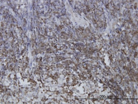 ANTI-STAT5B antibody produced in mouse