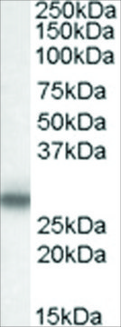 Anti-Myelin Protein Zero antibody produced