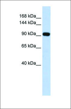 Anti-EVI1 (ab2) antibody produced in