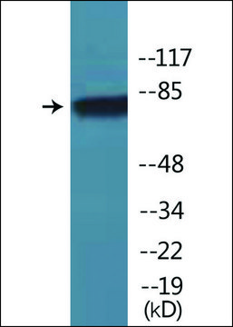 Anti-phospho-eEF2K (pSer³??) antibody produced in