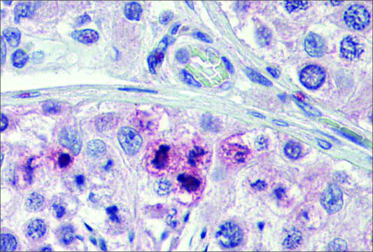 Anti-STAT5B (ab2) antibody produced in
