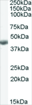 Anti-BHMT antibody produced in goat