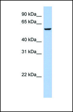 Anti-FBXO33 antibody produced in rabbit