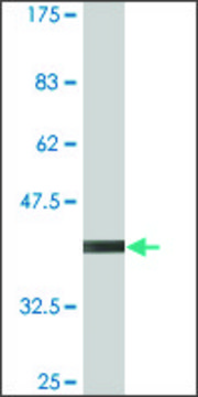 Monoclonal Anti-RNF182, (N-terminal) antibody produced