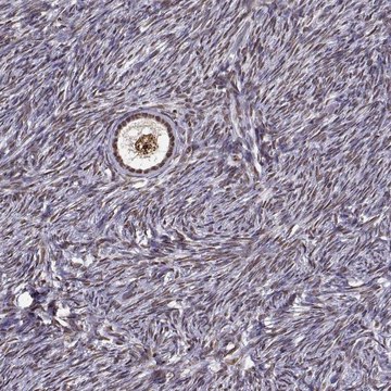 Anti-EZH1 antibody produced in rabbit