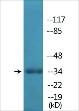Anti-phospho-TAL-1 (pSer¹²²) antibody produced in