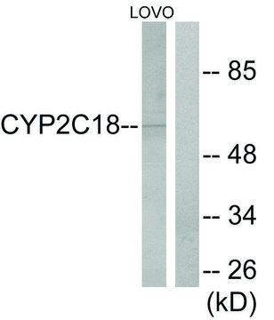 Anti-Cytochrome P450 2C8 antibody produced