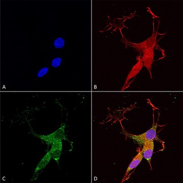 Monoclonal Anti-Copper Transporting Atpase 2