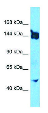 Anti-SLIT3 (N-terminal) antibody produced in