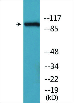 Anti-phospho-CBL (pTyr???) antibody produced in