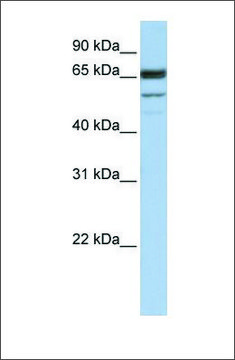 Anti-SEPN1 antibody produced in rabbit