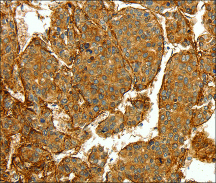 Anti-COL4A1 antibody produced in rabbit