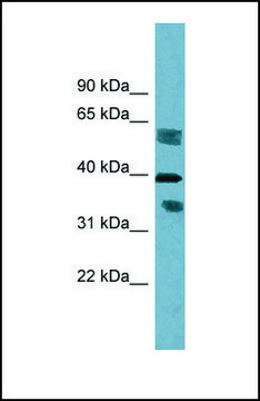 Anti-DHRS7B antibody produced in rabbit