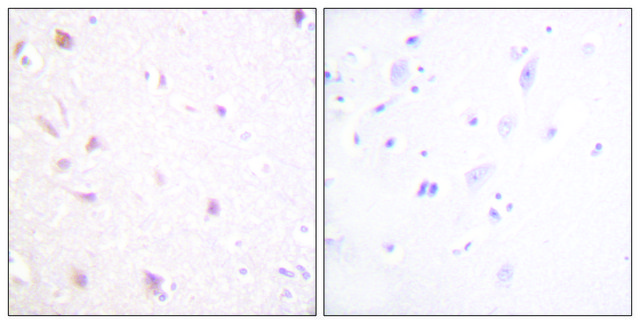 Anti-NIFK antibody produced in rabbit