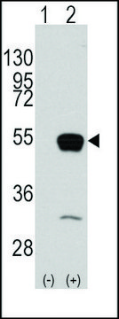 Anti-SMYD2 (C-term) antibody produced in