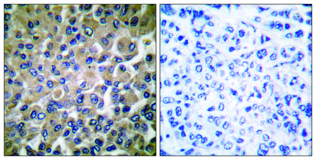 Anti-GRP78 antibody produced in rabbit