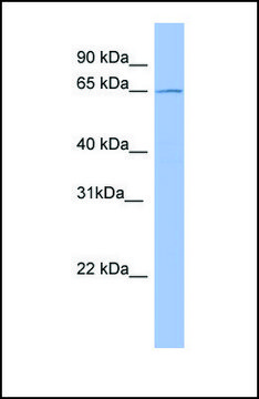 Anti-METTL3 antibody produced in rabbit
