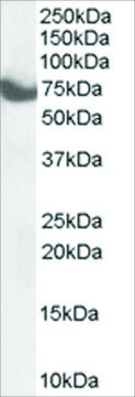 Anti-HIP14/ZDHHC17 antibody produced in goat