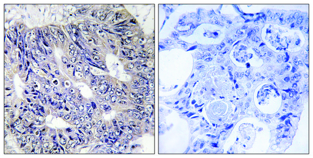 Anti-ES8L1 antibody produced in rabbit