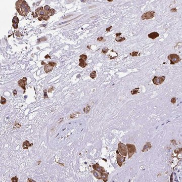 Anti-PIGK antibody produced in rabbit
