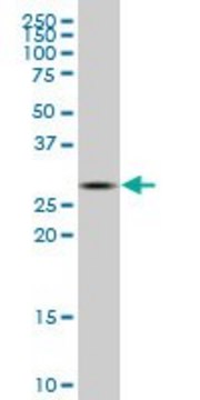 ANTI-CA1 antibody produced in mouse