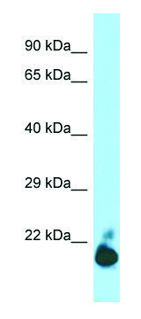 Anti-TIGIT (C-terminal) antibody produced in