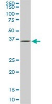 Monoclonal Anti-GLUL, (C-terminal) antibody produced