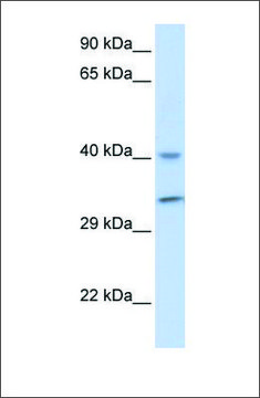 Anti-ALKBH3 antibody produced in rabbit