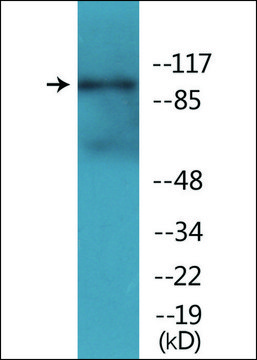 Anti-phospho-NMDAR1 (pSer???) antibody produced in