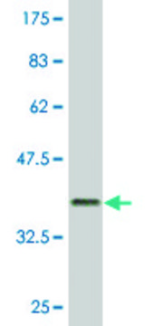 Monoclonal Anti-GIMAP2, (N-terminal) antibody produced