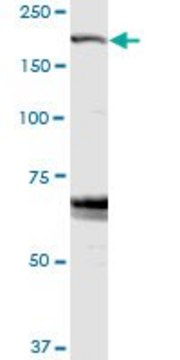Anti-ZFYVE9 antibody produced in rabbit