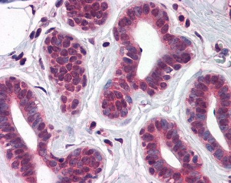 Anti-TBX18 (ab2) antibody produced in