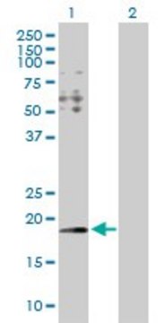 Anti-HYI antibody produced in rabbit
