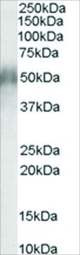 Anti-CD2BP2, N-Terminal antibody produced in