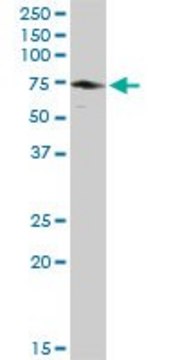 Anti-EPM2AIP1 antibody produced in rabbit